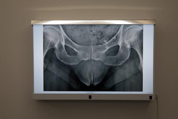 Galerie Steinek: Renate Bertlmann -  #It´s You,Too (17.1. - 1.3.2018) https://esel.at/termin/94529 | Foto: eSeL Foto: eSeL.at - Lorenz Seidler